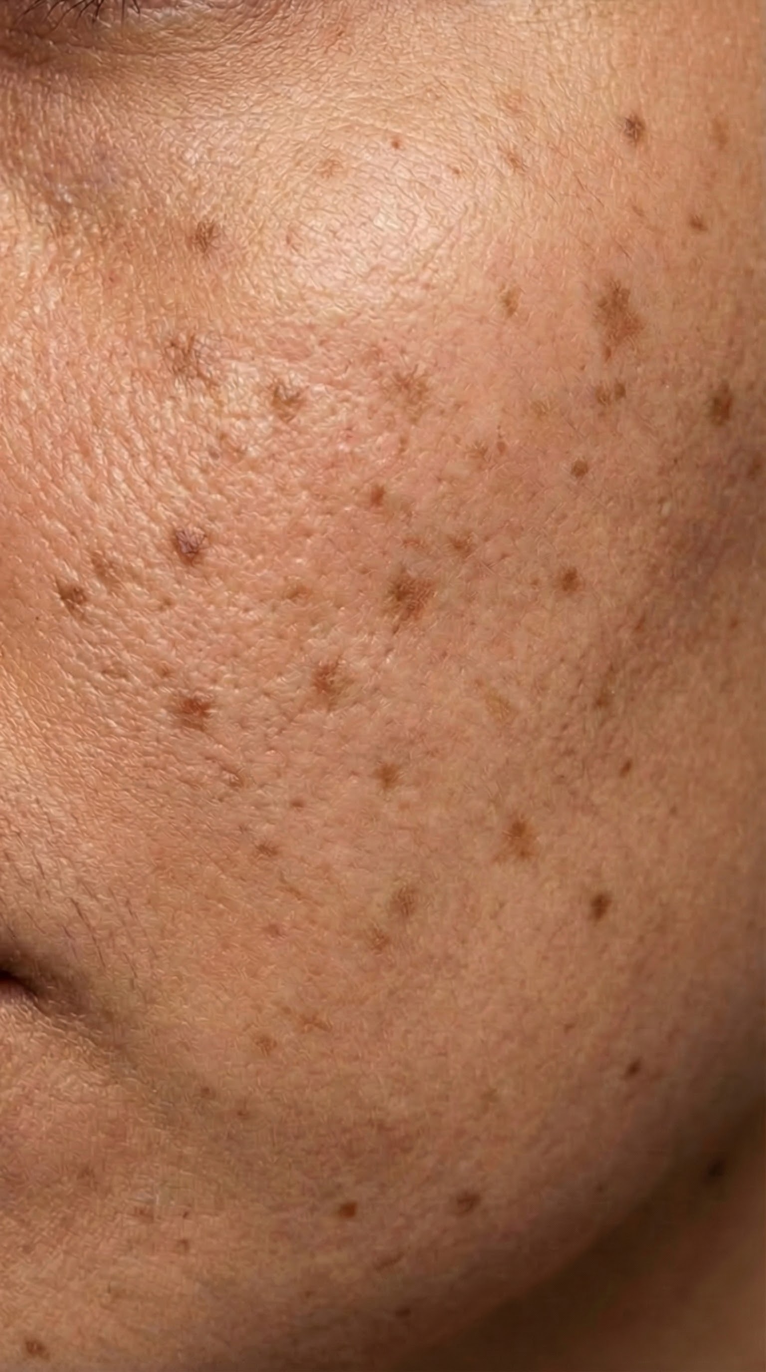 Woche 4 - Mikro-Relief