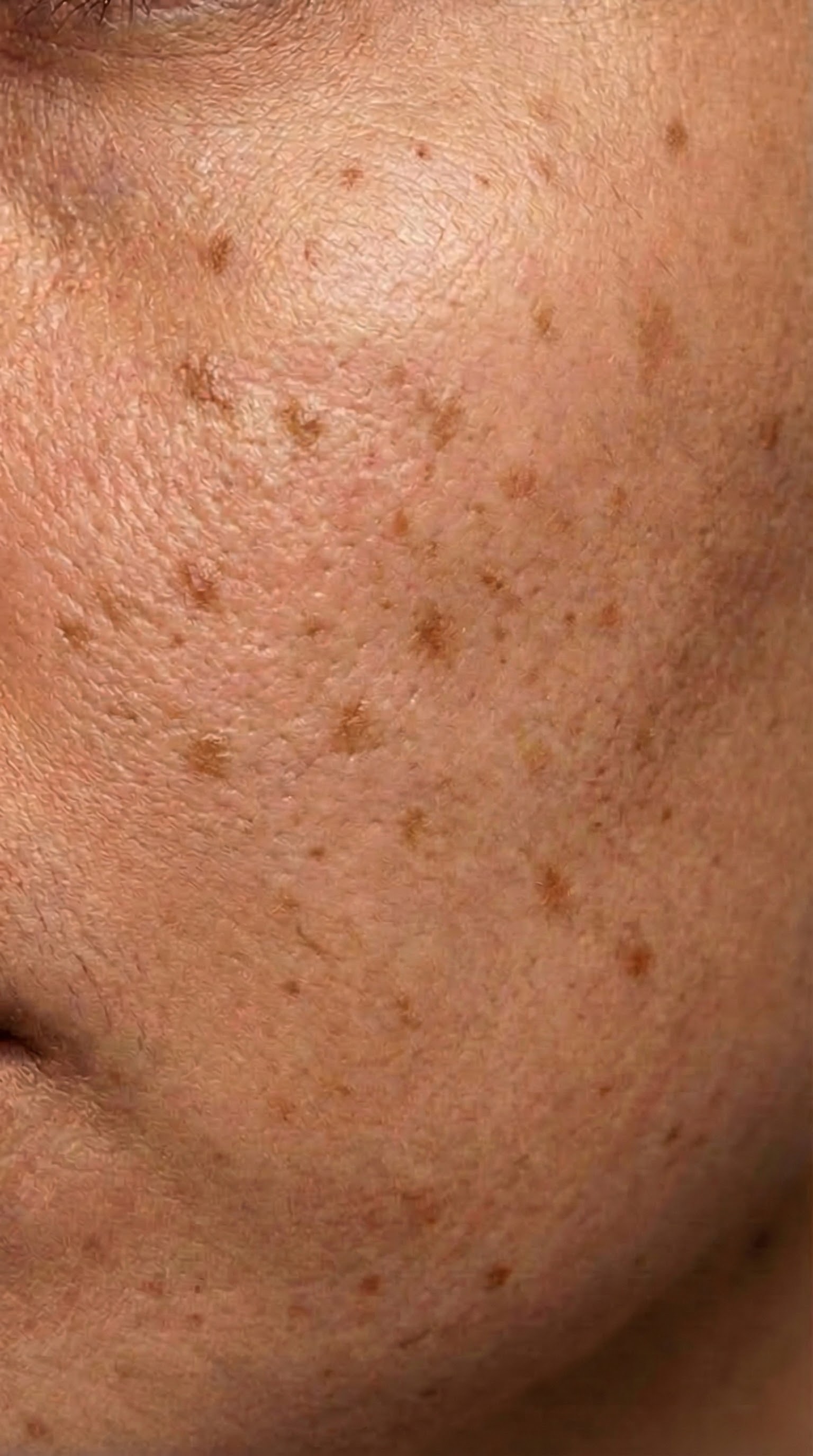 Woche 5 - Melanin-Balance