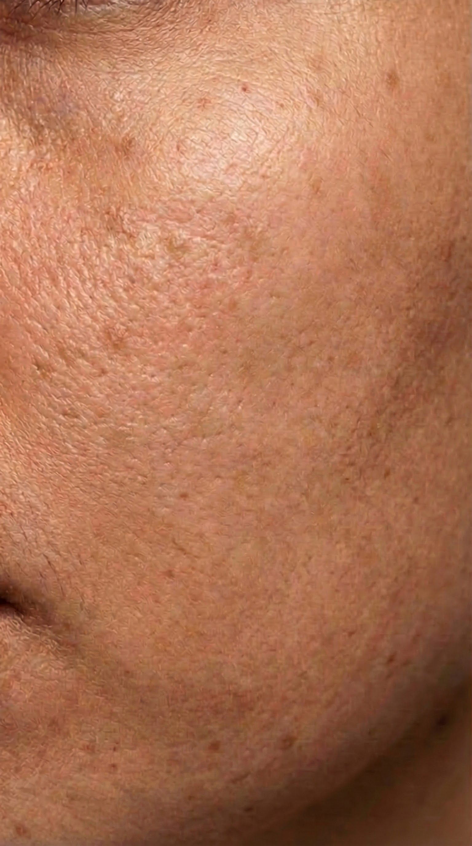 Woche 7 - Radiance Unlocked